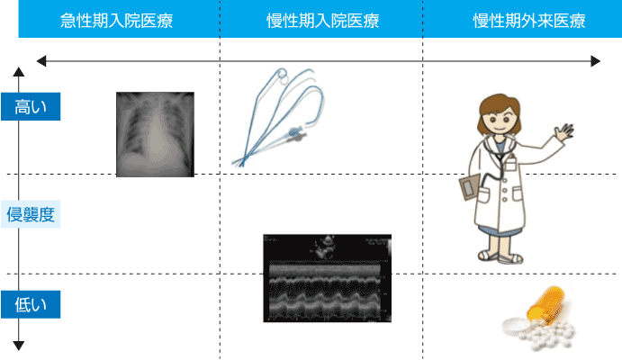 ワークシェアリング